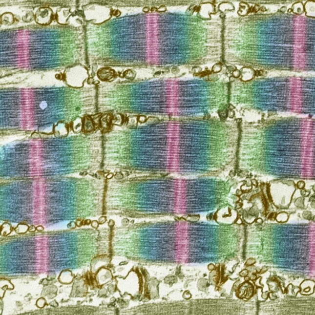 BridgeBio surges as muscle disorder drug scores 'best case' trial win