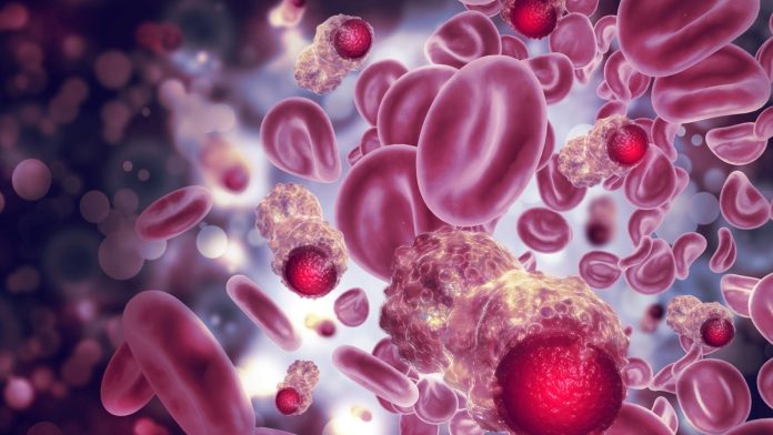 Regeneron drug wipes out residual multiple myeloma cells in small trial
