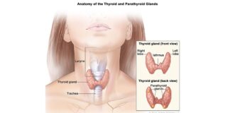 آیا پُرکاری پاراتیروئید درماننشده منجر به حملۀ قلبی میشود؟