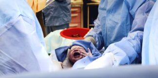 آمار سزارین در ایران بیش از ۳ برابر استاندارد جهانی