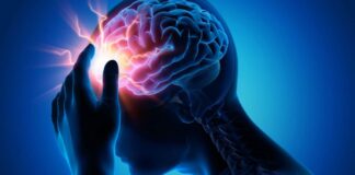 علائم سکته مغزی چیست؟