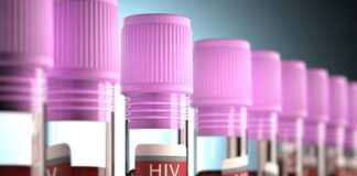 روابط جنسی بیشترین علت بروز HIV در ۱۴۰۱