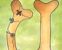 ابتلای دوسوم زنان بالای ۶۰ سال ایران به پوکی استخوان