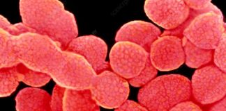 عفونت استرپتوکوک A در اروپا افزایشی شد