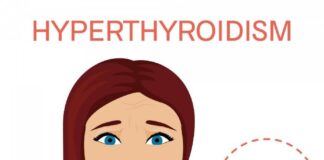 علائم پُرکاری تیروئید