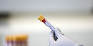 نشانگرهای خون میتوانند به شناسایی نوع نادری از بیماری آلزایمر کمک کنند