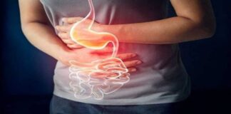 سرطان روده بزرگ؛ پیامد تلخ جوامع صنعتی