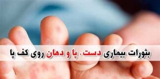 شیوع بیماری دست، پا و دهان