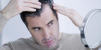 نوشیدن یک نوشابه در روز خطر طاسی را در مردان تا ۶۰ درصد افزایش میدهد