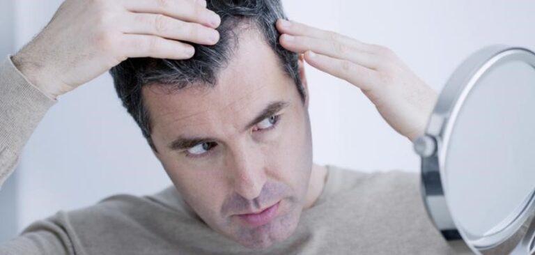 نوشیدن یک نوشابه در روز خطر طاسی را در مردان تا ۶۰ درصد افزایش می‌دهد