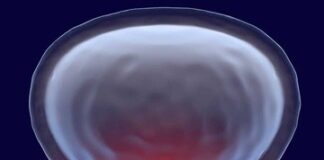 علائم سرطان پروستات