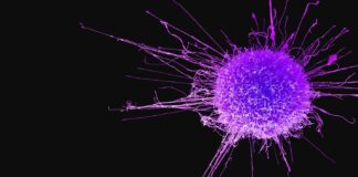 نوبتهای طولانی درمان سرطان در بخش دولتی