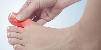 محرکهای درد نقرس چیست؟