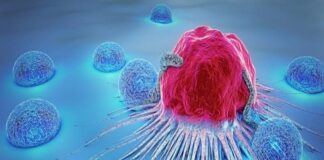 علائم سرطان در کودکان