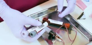 چگونگی و شرایط اهدای پلاکت