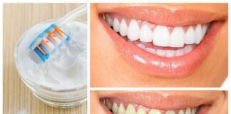 چند روش خانگی برای سفید کردن دندانها