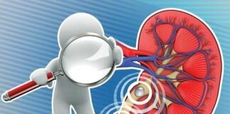 علائم نشاندهنده نارسایی کلیه