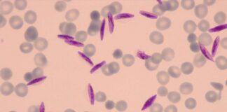 عدم ثبت مورد بومی مالاریا طی ۴ سال اخیر در کشور