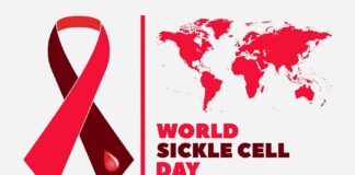 ۱۹ ژوئن؛ روز جهانی سلول داسیشکل