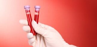 تداوم مشکلات دارویی بیماران هموفیلی