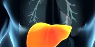 کبد چرب، قاتلی خاموش که میتازد