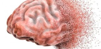 هر ۷ دقیقه یک ایرانی به زوالعقل مبتلا میشود