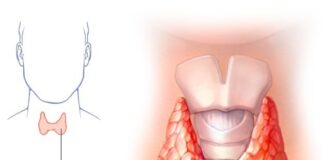 علائم کمکاری تیروئید در گروههای سنی مختلف
