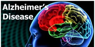 اسامی شرکتها و نام داروهای در حال ساخت برای درمان بیماری آلزایمر