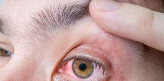 ۹۰۰ هزار بیمار مبتلا به آبسیاه از بیماری خود خبر ندارند