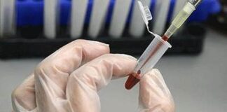 فعالیت بانک «خون بند ناف» در سازمان انتقال خون