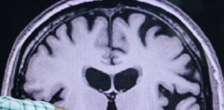 عملکرد موفقیتآمیز داروی ACI۱۹۳ در مرحله آزمایش ایمنی اولیه