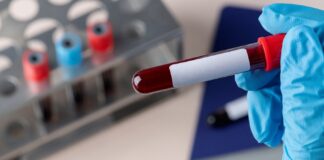 کمخونی و فقر آهن در ۳۰ درصد جمعیت جهان