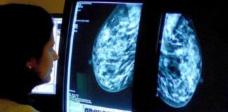 هوش مصنوعی در غربالگری سرطان پستان قابلاطمینان است