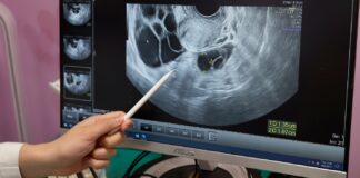 زنان تایوان به امید تغییر قانون، تخمکهای خود را بهعنوان “اقدام احتیاطی” منجمد میکنند