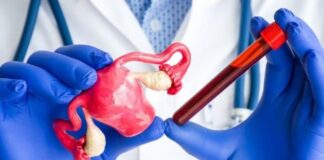 شایعترین علل ناباروری در زنان