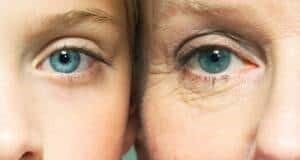 چین و چروکهای صورت درباره کدام بیماریها هشدار میدهند؟