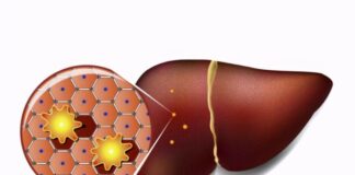 شیوع ۷ درصدی کبد چرب در نوجوانان