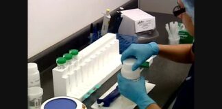 اهمیت تست پاپاسمیر در غربالگری یک سرطان زنانه