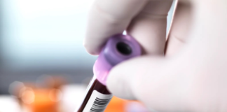 افزایش موارد سیفلیس در آمریکا و کمبود داروی Bicillin