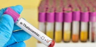 آسیب تحریم به بیماران تالاسمی