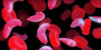 برای نخستین بار در جهان مجوز ژندرمانی اختلالات خونی صادر شد