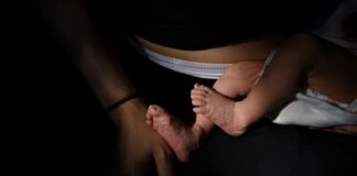 افزایش ۱۰ برابری موارد ابتلا به سیفلیس در نوزادان آمریکایی