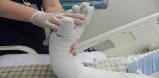 کمبود بیش از ۱۰۰۰ تخت سوختگی در کشور