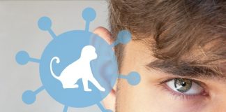 نخستین مرگ ناشی از mpox در ژاپن