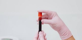 یک آزمایش خون ۳ دلاری قادر به تشخیص زودهنگام چندین سرطان است