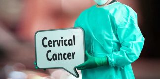 علائم سرطان دهانه رحم در مراحل اولیه و پیشرفته