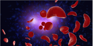 عملکرد موفقیتآمیز داروی خوراکی mitapivat برای درمان اَشکال کمتر شدید تالاسمی در یک مطالعه فاز نهایی