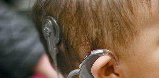 هزینه ۲۰۰ میلیونی کاشت حلزون شنوایی رایگان شد