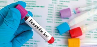 خدمات صندوق بیماریهای خاص و صعبالعلاج به مبتلایان هموفیلی