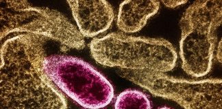 آغاز آزمایش انسانی واکسن ویروس نیپا